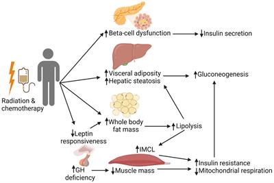 Diabetes in childhood cancer survivors: emerging concepts in pathophysiology and future directions